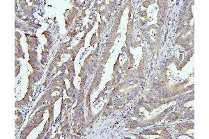 IHC analysis of EIF4G1 using anti-EIF4G1 antibody (ABIN7601860).