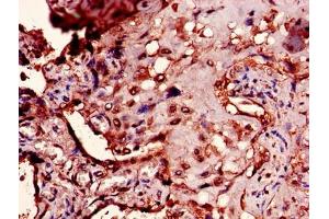 Immunohistochemistry of paraffin-embedded human placenta tissue using ABIN7166476 at dilution of 1:100 (PTMA anticorps  (AA 5-110))