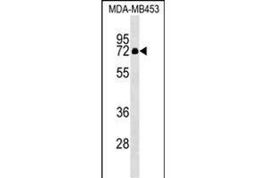 ZNF57 Antibody (N-term) (ABIN1539583 and ABIN2849296) western blot analysis in MDA-M cell line lysates (35 μg/lane). (ZFP57 anticorps  (N-Term))