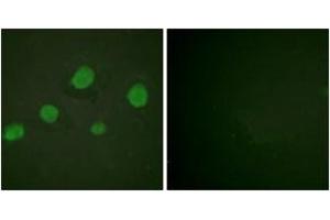Immunofluorescence analysis of HuvEc cells, using GATA3 (Phospho-Ser308) Antibody. (GATA3 anticorps  (pSer308))