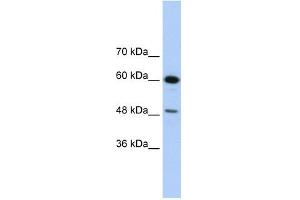 WB Suggested Anti-DAZAP1 Antibody Titration:  1. (DAZAP1 anticorps  (C-Term))