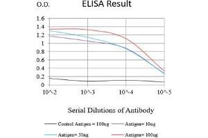 Black line: Control Antigen (100 ng),Purple line: Antigen (10 ng), Blue line: Antigen (50 ng), Red line:Antigen (100 ng)