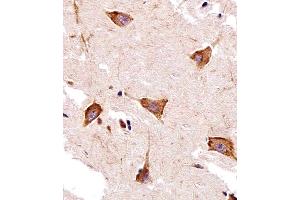 Immunohistochemical analysis of paraffin-embedded H. (GPR58 anticorps  (N-Term))