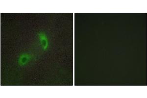 Immunofluorescence analysis of HUVEC cells, using HGS antibody.