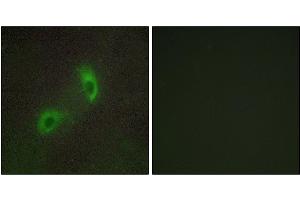 Immunofluorescence analysis of HUVEC cells, using HGS antibody. (HGS anticorps)