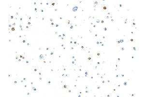 Immunocytochemistry (ICC) image for anti-Mast/stem Cell Growth Factor Receptor (KIT) (AA 325-375) antibody (ABIN7795658) (Recombinant KIT anticorps  (AA 325-375))