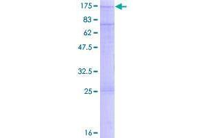 Image no. 1 for Sorting Nexin 13 (SNX13) (AA 1-957) protein (GST tag) (ABIN1320863)