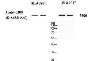 Western Blot (WB) analysis of HeLa 293T using EP300 antibody. (p300 anticorps)