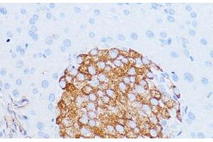 Immunohistochemistry of paraffin-embedded Mouse pancreas using NOTCH3 Polyclonal Antibody at dilution of 1:100 (40x lens). (NOTCH3 anticorps)