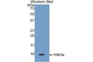 Western blot analysis of the recombinant protein. (CCL19 anticorps  (AA 32-103))