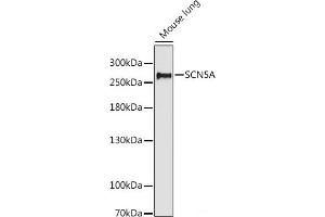 Western blot analysis of extracts of Mouse lung using SCN5A Polyclonal Antibody at dilution of 1:1000. (SCN5A anticorps)