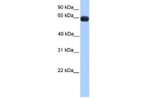 WB Suggested Anti-ZNF100 Antibody Titration:  0. (ZNF100 anticorps  (N-Term))