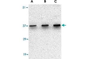 Western blot analysis of UNG in C2C12 cell lysate with UNG polyclonal antibody  at (A) 0. (UNG anticorps  (C-Term))