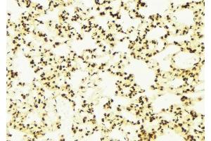 anti-Cyclin-Dependent Kinase-Like 5 (CDKL5) (Internal Region) antibody