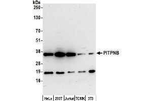 anti-Phosphotidylinositol Transfer Protein, beta (PITPNB) (AA 221-271) antibody