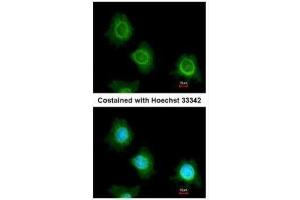 ICC/IF Image Immunofluorescence analysis of methanol-fixed HeLa, using PF4V1, antibody at 1:200 dilution. (PF4V1 anticorps  (C-Term))