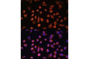 Immunofluorescence analysis of L929 cells using EDEM2 Rabbit pAb (ABIN7267004) at dilution of 1:100. (EDEM2 anticorps  (AA 399-578))