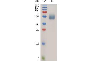 Human IL1R2 Protein, His Tag on SDS-PAGE under reducing condition.