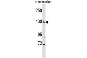 Western Blotting (WB) image for anti-TBC1 Domain Family, Member 8 (With GRAM Domain) (TBC1D8) antibody (ABIN2999068)
