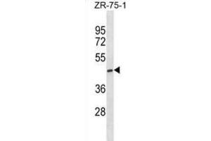 Western Blotting (WB) image for anti-ST6 (Alpha-N-Acetyl-Neuraminyl-2,3-beta-Galactosyl-1,3)-N-Acetylgalactosaminide alpha-2,6-Sialyltransferase 5 (ST6GALNAC5) antibody (ABIN3000960) (ST6GALNAC5 anticorps)