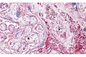 Detection of ENTPD1 in Human Placenta Tissue using Polyclonal Antibody to Ectonucleoside Triphosphate Diphosphohydrolase 1 (ENTPD1)