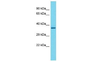 Host:  Rabbit  Target Name:  Tcea2  Sample Type:  Rat Spleen lysates  Antibody Dilution:  1. (TCEA2 anticorps  (Middle Region))