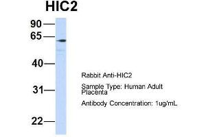 Host:  Rabbit  Target Name:  HIC2  Sample Type:  Human Adult Placenta  Antibody Dilution:  1. (HIC2 anticorps  (Middle Region))