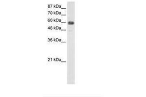 Image no. 2 for anti-TROVE Domain Family, Member 2 (TROVE2) (AA 51-100) antibody (ABIN203195) (TROVE2 anticorps  (AA 51-100))