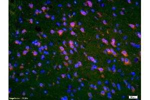 Formalin-fixed and paraffin-embedded rat brain labeled with Anti-PMP2 Polyclonal Antibody, Unconjugated (ABIN676823) 1:200, overnight at 4°C, The secondary antibody was Goat Anti-Rabbit IgG, Cy3 conjugated used at 1:200 dilution for 40 minutes at 37°C. (PMP2 anticorps  (AA 31-132))