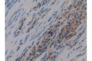 DAB staining on IHC-P;;Samples: Human Lung Tissue (Preprovasopressin (AA 21-164) anticorps)