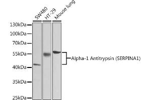 Western blot analysis of extracts of various cell lines, using Alpha-1 Antitrypsin (Alpha-1 Antitrypsin (SERPIN)) antibody (2481) at 1:1000 dilution. (SERPINA1 anticorps  (AA 25-315))