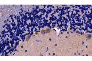 Detection of TNFa in Rat Cerebellum Tissue using Polyclonal Antibody to Tumor Necrosis Factor Alpha (TNFa) (TNF alpha anticorps  (AA 80-235))