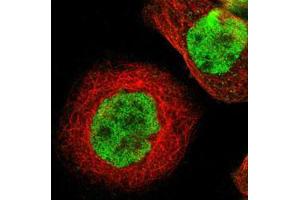 Immunofluorescent staining of A-431 cells with ZBTB7B polyclonal antibody  (Green) shows positivity in nucleus but excluded from the nucleoli. (ZBTB7B anticorps)