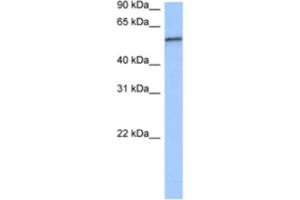 Western Blotting (WB) image for anti-RNA Pseudouridylate Synthase Domain Containing 2 (RPUSD2) antibody (ABIN2462339) (RPUSD2 anticorps)