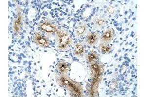 GGTLA4 antibody was used for immunohistochemistry at a concentration of 4-8 ug/ml to stain Epithelial cells of renal tubule (arrows) in Human Kidney. (GGTLC1 anticorps  (C-Term))