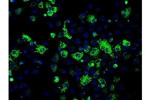 Image no. 3 for anti-Fumarate Hydratase (FH) antibody (ABIN1498267)