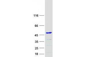 Validation with Western Blot