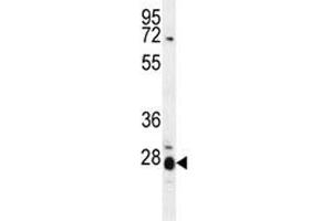 IL17B antibody western blot analysis in mouse spleen tissue lysate. (IL17B anticorps  (AA 39-66))