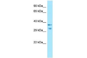 WB Suggested Anti-MRGPRX1 Antibody Titration: 1.