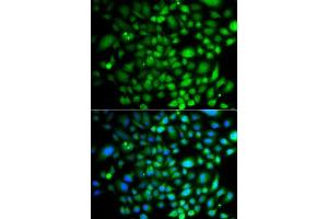 Immunofluorescence analysis of A549 cells using PTK6 antibody. (PTK6 anticorps  (AA 222-451))