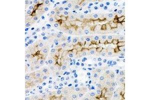Immunohistochemical analysis of IRSp53 staining in rat kidney formalin fixed paraffin embedded tissue section. (BAIAP2 anticorps)