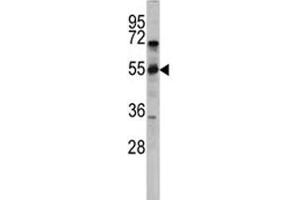 Western blot analysis of CD36 antibody and CEM lysate. (CD36 anticorps  (AA 213-242))