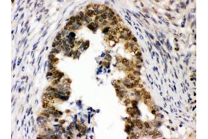 Immunohistochemistry (Paraffin-embedded Sections) (IHC (p)) image for anti-Ubiquitin-Like, Containing PHD and RING Finger Domains, 1 (UHRF1) (AA 14-51), (N-Term) antibody (ABIN3044567)