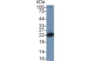 Detection of PARK7 in Rat Heart lysate using Polyclonal Antibody to Parkinson Disease Protein 7 (PARK7) (PARK7/DJ1 anticorps  (AA 1-189))