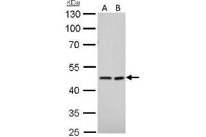 WB Image NDRG1 antibody detects NDRG1 protein by Western blot analysis. (NDRG1 anticorps)