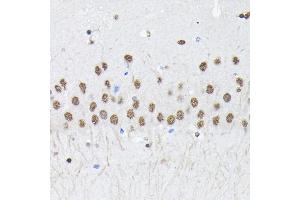 Immunohistochemistry of paraffin-embedded mouse brain using PTBP2 Rabbit pAb (ABIN6128372, ABIN6146373, ABIN6146374 and ABIN6221684) at dilution of 1:100 (40x lens). (PTBP2 anticorps  (AA 1-280))