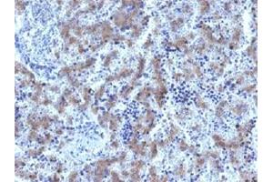 Immunohistochemical staining (Formalin-fixed paraffin-embedded sections) of human fetal liver with GPC3 recombinant monoclonal antibody, clone GPC3/1534R . (Recombinant Glypican 3 anticorps)