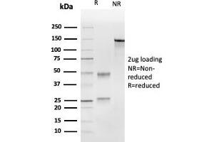 SDS-PAGE Analysis Purified UBE2C Mouse Monoclonal Antibody (CPTC-UBE2C-1). (UBE2C anticorps)