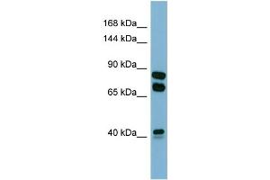 Host:  Rabbit  Target Name:  PXDN  Sample Type:  COLO205 Whole cell lysates  Antibody Dilution:  1. (Peroxidasin anticorps  (N-Term))