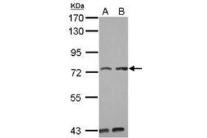 Image no. 2 for anti-Pumilio RNA Binding Family Member 3 (PUM3) (AA 415-648) antibody (ABIN1499029) (KIAA0020 anticorps  (AA 415-648))